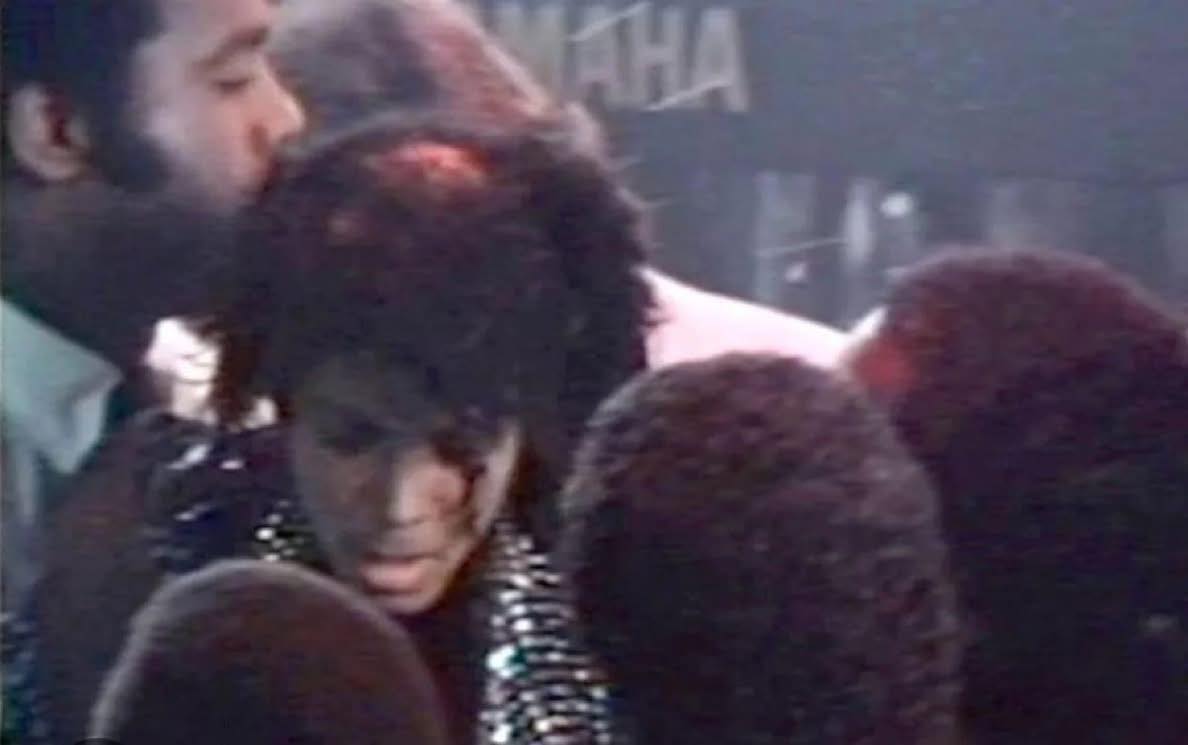 Michael-Jackson-Pepsi-incident