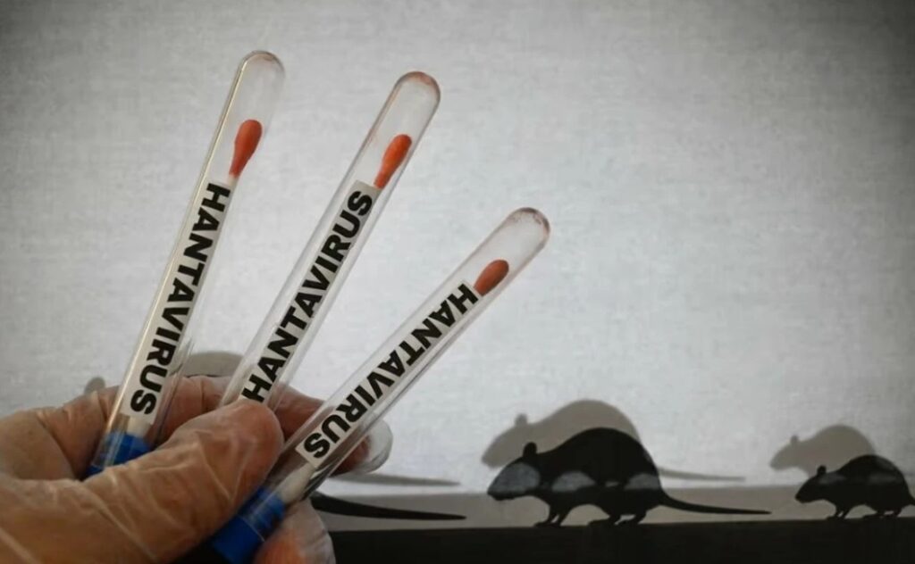 Symptoms of Hantavirus: Early Signs, Causes, and Prevention